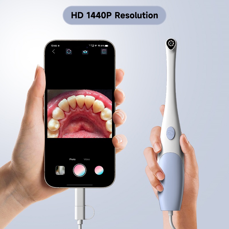 Oral Endoscope Camera 1440P Ph - Photography And Videography Lighting review and price