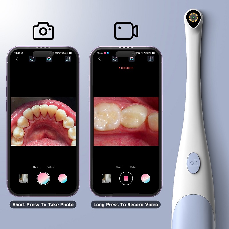 Oral Endoscope Camera 1440P Ph - Photography And Videography Lighting review and price